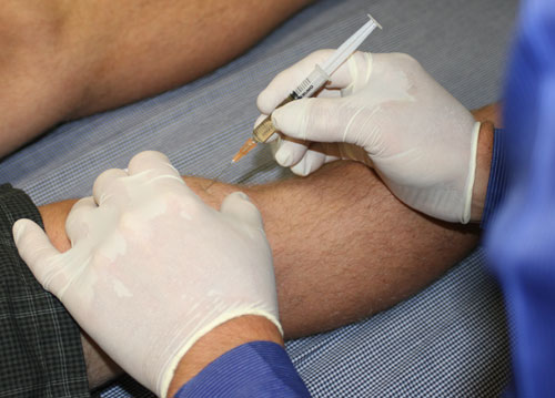 PRP Platelet Rich Plasma Injections