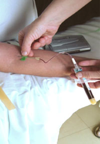 PRP Platelet Rich Plasma Injections - Venesection